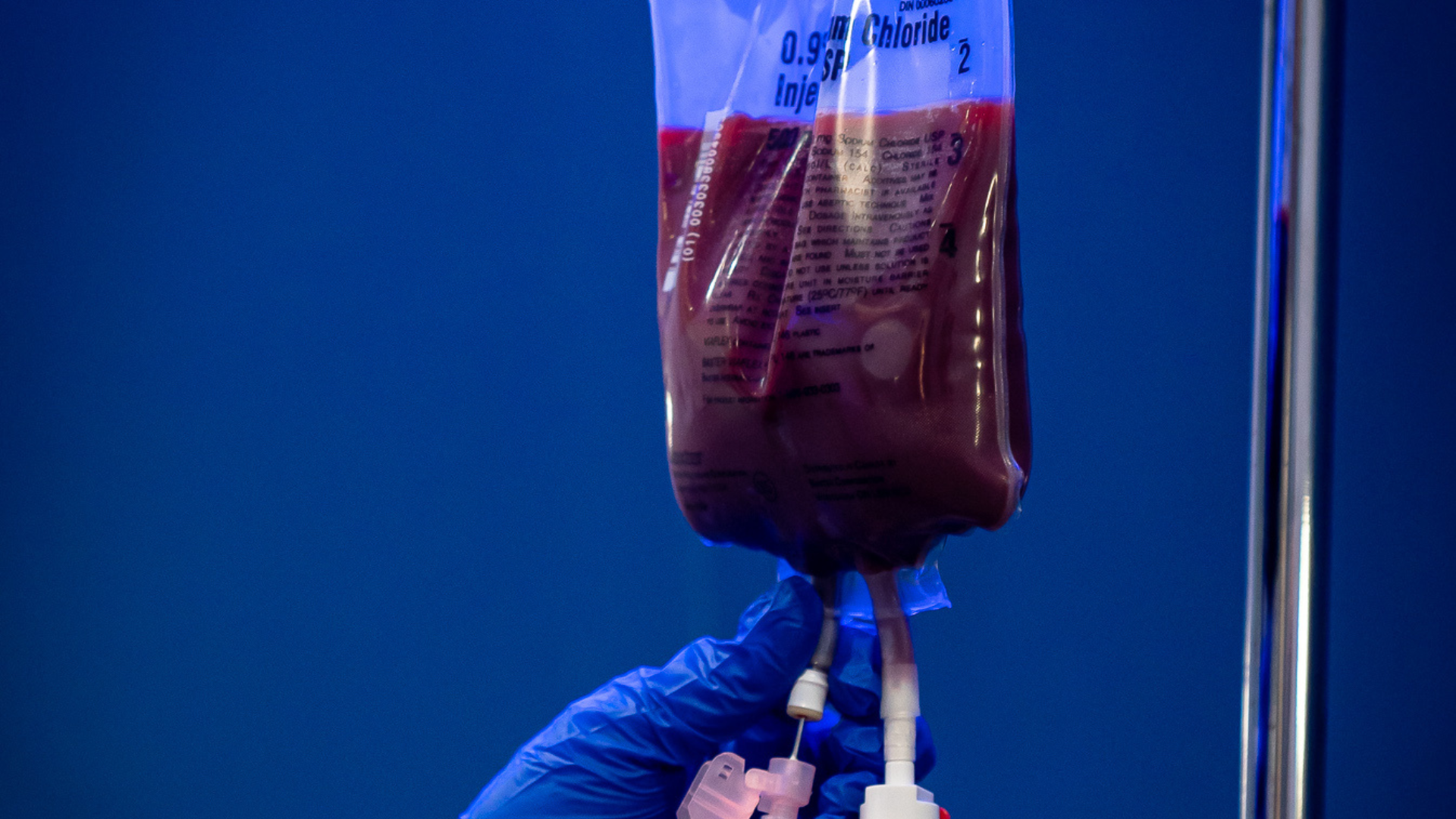 iCRYO Okatie-Bluffton Ozone UV IV infusion bag